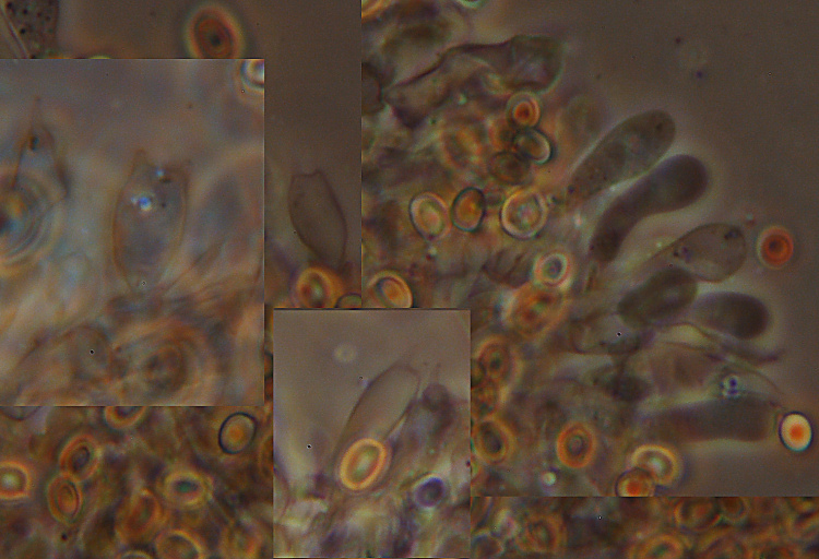 A. xantoderma?